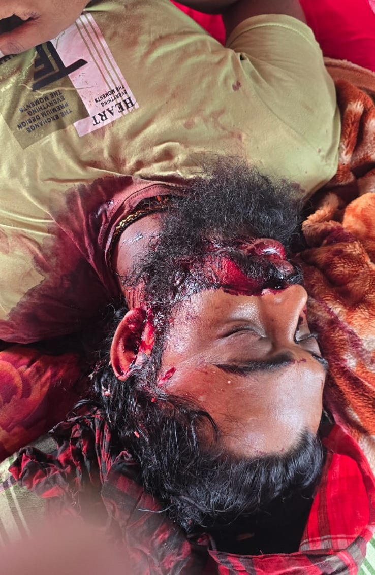পদ্মার চরে বালুমহল দখল নিয়ে ৩ সন্ত্রাসী বাহিনীর বন্দুকযুদ্ধ, নিহত ১