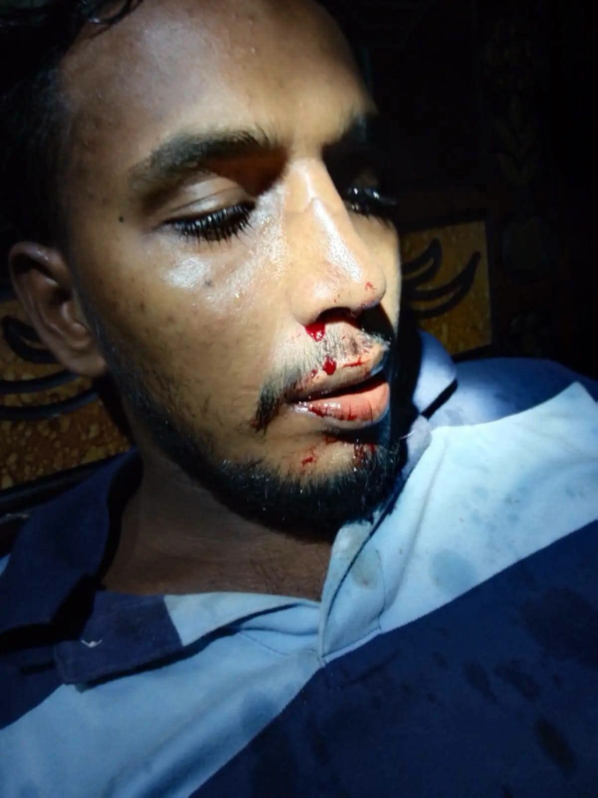 বরিশালে মসজিদ থেকে তুলে নিয়ে ছাত্রলীগ কর্মীর ওপর হামলা