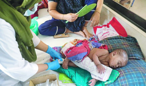 গত ২৪ ঘণ্টায় হামে ৪ জনের মৃত্যু, শনাক্ত ১ হাজার ছাড়িয়েছে