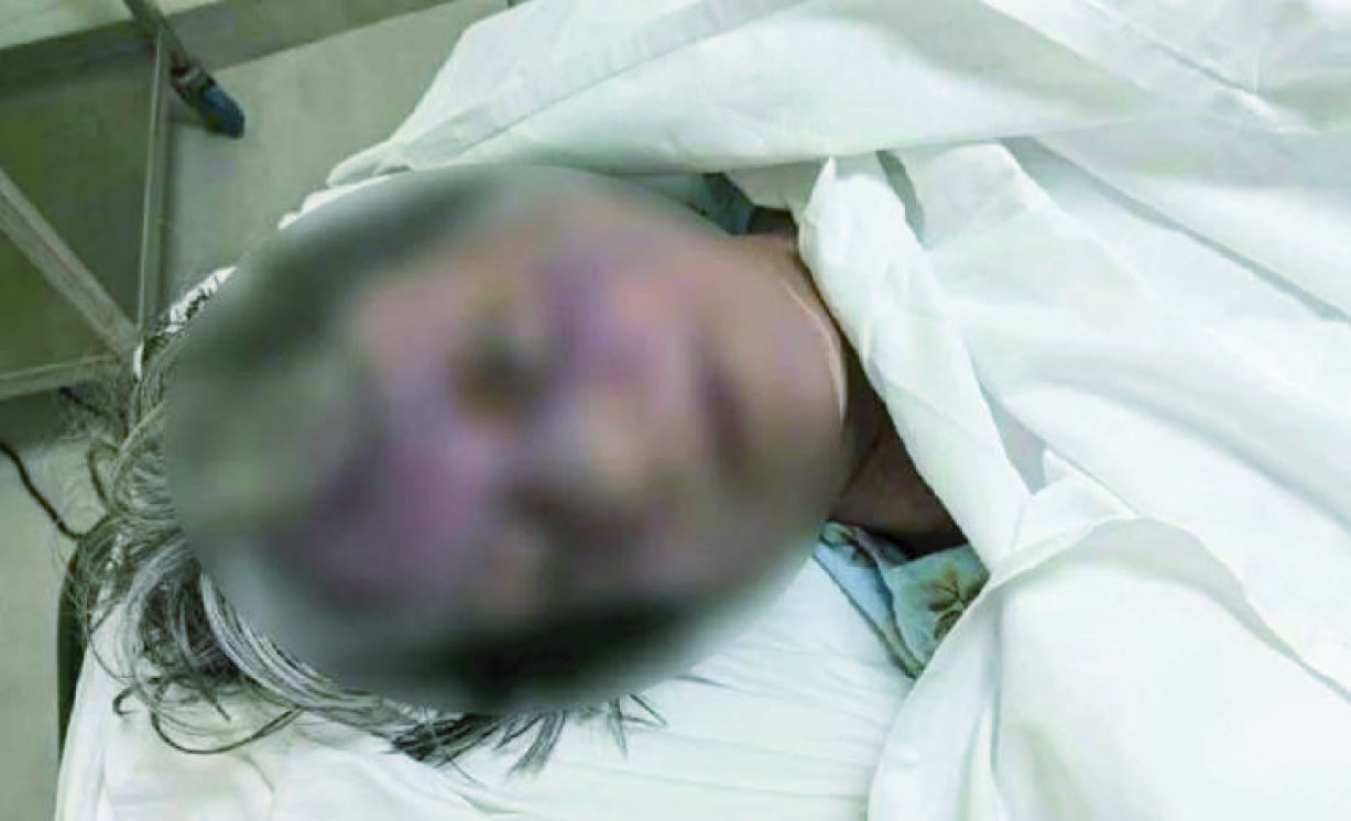 গুলশানে বিদেশি নাগরিকের রহস্যজনক মৃত্যু, পিটিয়ে হত্যার অভিযোগ