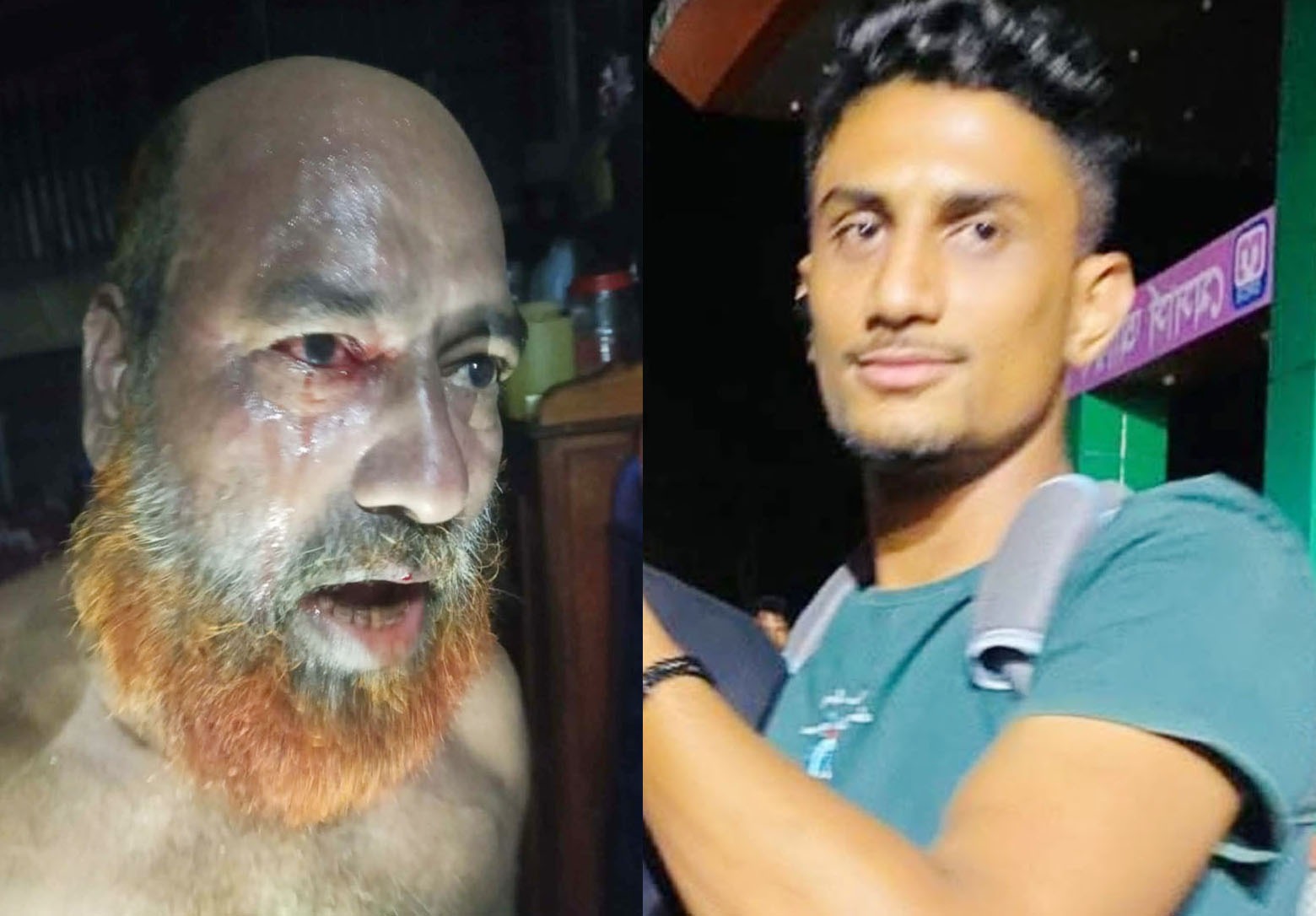 গৃহকর্তার চোখে খোচা দিয়ে পালালো চোর