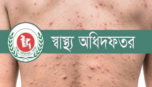 ২৪ ঘণ্টায় হামে ৮ জনের মৃত্যু, মোট মৃত্যু ৮শ ছাড়িয়েছে