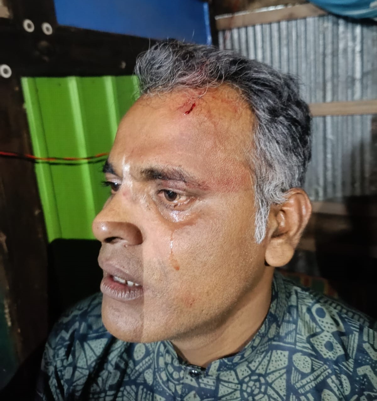 নাজিরপুরে স্বেচ্ছাসেবক দল নেতাকে কুপিয়ে আহত করার অভিযোগ