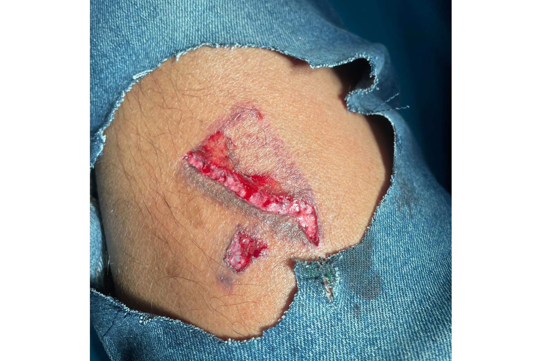 f56c8fec-b1d9-471d-b761-07e363e528d337707