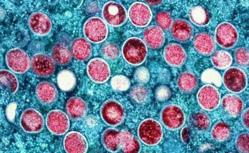 47d5e379-4378-45a6-8365-34ab0ed2a95e27055