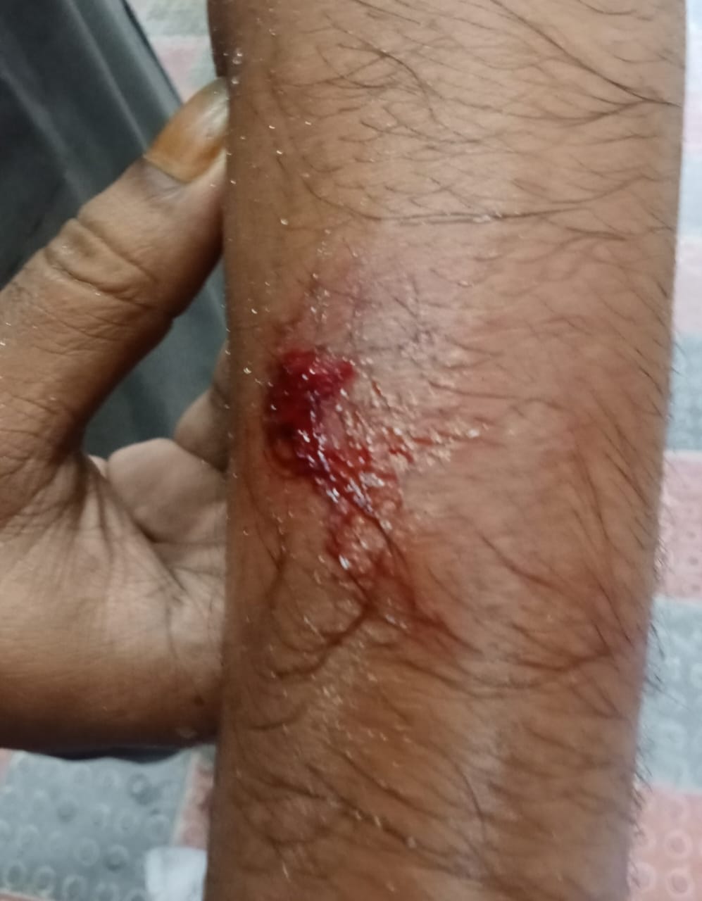 23200fbf-0f06-4b49-ba28-2b8c1ec2207434556